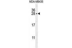 CSH1 Antibody (C-term) western blot analysis in MDA-MB435 cell line lysates (35µg/lane).
