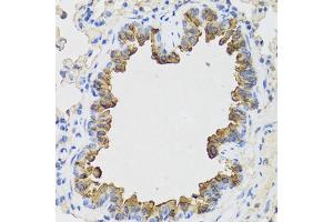 Immunohistochemistry of paraffin-embedded mouse lung using B9D1 antibody. (B9D1 anticorps)