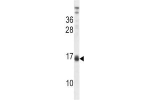 Western Blotting (WB) image for anti-Lactalbumin, alpha- (LALBA) antibody (ABIN2998275) (LALBA anticorps)