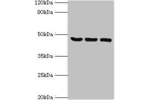 Western blot All lanes: SYT11 antibody at 14 μg/mL Lane 1: COLO205 whole cell lysate Lane 2: Mouse skeletal muscle tissue Lane 3: MCF-7 whole cell lysate Secondary Goat polyclonal to rabbit IgG at 1/10000 dilution Predicted band size: 48 kDa Observed band size: 48 kDa (SYT11 anticorps  (AA 37-200))