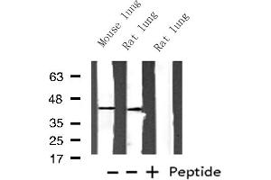 Western blot analysis of Histone PDGFRL expression in various lysates (PDGFRL anticorps  (Internal Region))