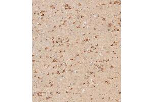 Immunohistochemical analysis of paraffin-embedded human brain tissue using C performed on the Leica® BOND RXm. (IFNAR1 anticorps  (AA 162-188))