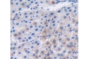 IHC-P analysis of Kidney tissue, with DAB staining. (MT1 anticorps)