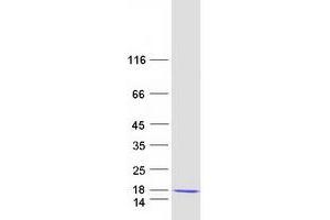 Validation with Western Blot