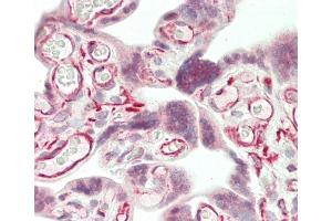 Formalin-fixed and paraffin-embedded H.