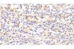Detection of PLCb3 in Human Small intestine Tissue using Polyclonal Antibody to Phospholipase C Beta 3, Phosphoinositide Specific (PLCb3)