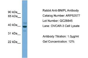 WB Suggested Anti-BNIPL  Antibody Titration: 0. (BNIPL anticorps  (Middle Region))