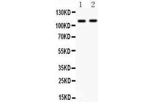 Western Blotting (WB) image for anti-Nucleotide-Binding Oligomerization Domain Containing 1 (NOD1) (AA 1-160) antibody (ABIN3043890) (NOD1 anticorps  (AA 1-160))