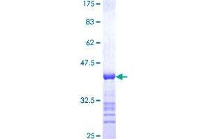 SUPV3L1 Protein (AA 687-786) (GST tag)