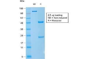 SDS-PAGE Analysis Purified CD1a Mouse Recombinant Monoclonal Antibody (rC1A/711). (Recombinant CD1a anticorps)