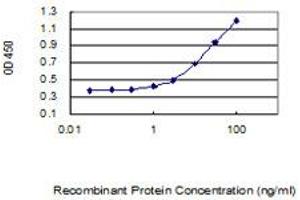 Detection limit for recombinant GST tagged KIAA1191 is 0.