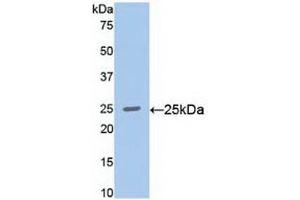 Detection of Recombinant RALA, Human using Polyclonal Antibody to V-Ral Simian Leukemia Viral Oncogene Homolog A (RALA) (rala anticorps  (AA 1-206))