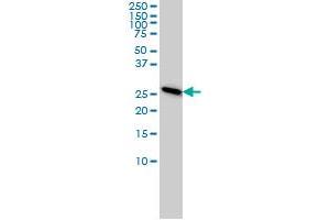 PSMA7 monoclonal antibody (M01), clone 1A10-3G12 Western Blot analysis of PSMA7 expression in HeLa .