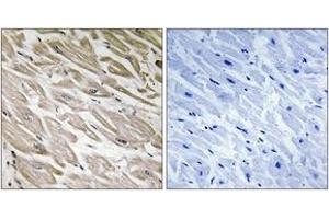 Immunohistochemistry analysis of paraffin-embedded human heart, using PPP1R2 (Phospho-Ser120+Ser121) Antibody.