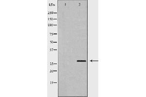 Western blot analysis of A549 whole cell lysates, using PSMA3 Antibody.