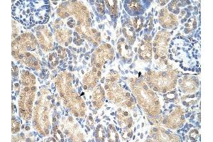 PRMT1 antibody was used for immunohistochemistry at a concentration of 4-8 ug/ml to stain Epithelial cells of renal tubule (arrows) in Human Kidney.