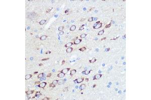 Immunohistochemistry of paraffin-embedded rat brain using GluR2/GRI Rabbit mAb (ABIN7267414) at dilution of 1:100 (40x lens). (GRIA2 anticorps)