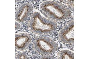 Immunohistochemical staining of human corpus, uterine with YIPF4 polyclonal antibody  shows strong cytoplasmic positivity, with a granular pattern, in glandular cells. (YIPF4 anticorps)