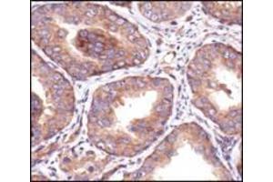 Image no. 1 for anti-Insulin-Like Growth Factor 1 Receptor (IGF1R) (C-Term) antibody (ABIN228595)
