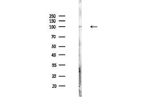 anti-Vav 1 Oncogene (VAV1) (pTyr174) antibody