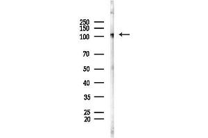 anti-Oxoglutarate Dehydrogenase-Like (OGDHL) (Internal Region) antibody