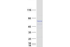 Validation with Western Blot