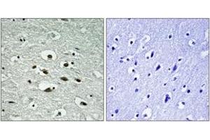 Immunohistochemistry analysis of paraffin-embedded human brain, using Chk1 (Phospho-Ser296) Antibody. (CHEK1 anticorps  (pSer296))