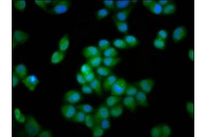 Immunofluorescence staining of Hela cells with ABIN7156413 at 1:66, counter-stained with DAPI. (INTS3 anticorps  (AA 901-1043))