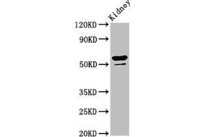 Western Blot Positive WB detected in: Rat kidney tissue All lanes: CYP8B1 antibody at 6. (CYP8B1 anticorps  (AA 303-440))