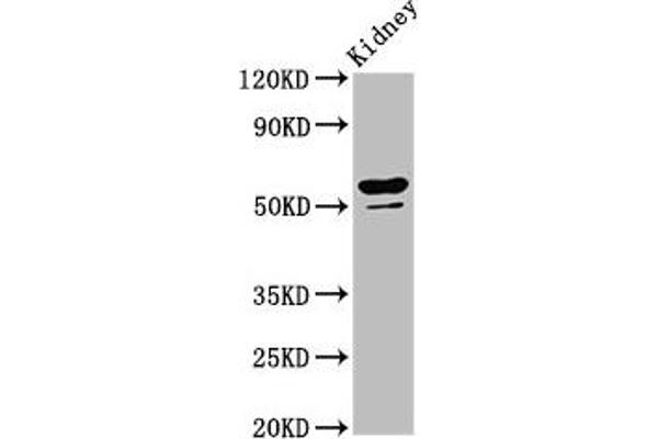 CYP8B1 anticorps  (AA 303-440)