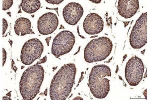 IHC analysis of NAK/TBK1 using anti-NAK/TBK1 antibody (ABIN7599532). (TBK1 anticorps  (AA 1-729))