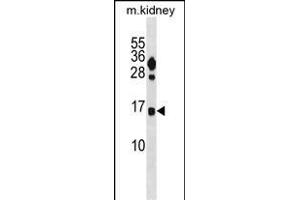 FUNDC2 Antibody (C-term) (ABIN1881354 and ABIN2839012) western blot analysis in mouse kidney tissue lysates (35 μg/lane). (FUNDC2 anticorps  (C-Term))