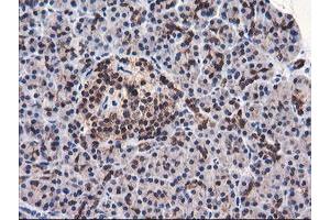 Image no. 4 for anti-F-Box Protein 21 (FBXO21) antibody (ABIN1498232) (FBXO21 anticorps)