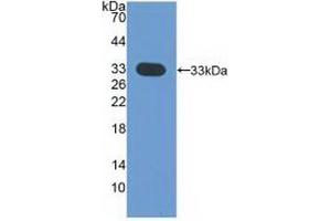 Western blot analysis of recombinant Human CDK4. (CDK4 anticorps  (AA 6-295))