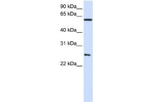 WB Suggested Anti-CCT7  Antibody Titration: 0. (CCT7 anticorps  (Middle Region))