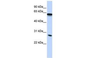 Image no. 1 for anti-Inhibin Binding Protein (INHBP) (C-Term) antibody (ABIN6743125) (IGSF1 anticorps  (C-Term))