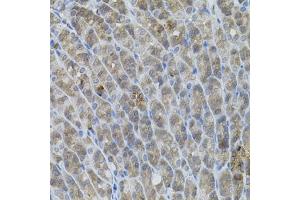Immunohistochemistry of paraffin-embedded mouse stomach using UBE2A antibody (ABIN6132760, ABIN6149782, ABIN6149784 and ABIN6223686) (40x lens).