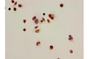 Immunocytochemistry analysis of Hela cells using ABIN7139166 at dilution of 1:100