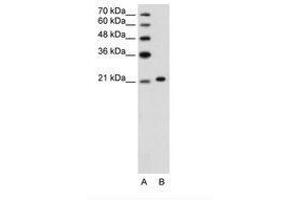 Image no. 3 for anti-Ankyrin 1, Erythrocytic (ANK1) (C-Term) antibody (ABIN203434) (Erythrocyte Ankyrin anticorps  (C-Term))
