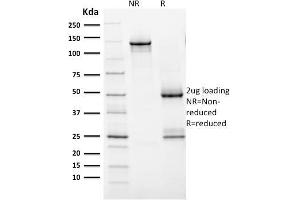 SDS-PAGE Analysis Purified HER-2 Mouse Monoclonal Antibody (ERBB2/2452).