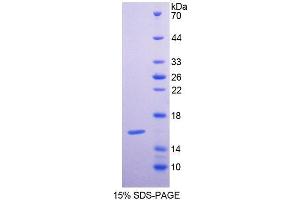 SDS-PAGE analysis of Human GCA Protein. (Grancalcin Protéine)
