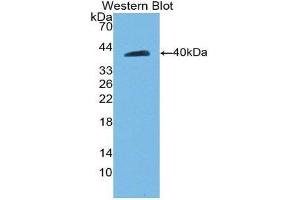Western Blotting (WB) image for anti-Cadherin 5 (CDH5) (AA 59-382) antibody (ABIN1858328) (Cadherin 5 anticorps  (AA 59-382))