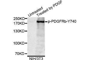 Western blot analysis of extracts of NIH/3T3 cells, using Phospho-PDGFRb-Y740 antibody. (PDGFRB anticorps)