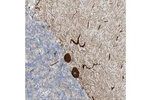 Immunohistochemical staining of human cerebellum with SEMA3F polyclonal antibody  shows strong cytoplasmic positivity in Purkinje cells. (SEMA3F anticorps)