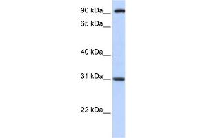WB Suggested Anti-ANKRA2 Antibody Titration:  0. (ANKRA2 anticorps  (C-Term))