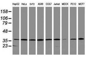 Image no. 3 for anti-Apurinic/Apyrimidinic Endonuclease 1 (APEX1) (AA 1-242) antibody (ABIN1490626) (APEX1 anticorps  (AA 1-242))