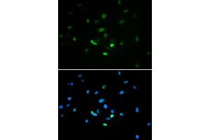 Immunofluorescence analysis of MCF-7 cells using TP53 antibody (ABIN5971632). (p53 anticorps)