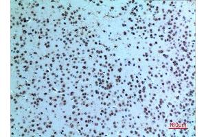 Immunohistochemistry (IHC) analysis of paraffin-embedded Mouse Brain, antibody was diluted at 1:100. (KRT14 anticorps  (C-Term))