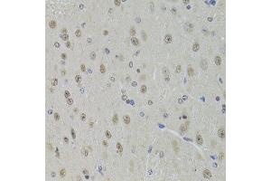 Immunohistochemistry of paraffin-embedded mouse brain using DDX1 Antibody.