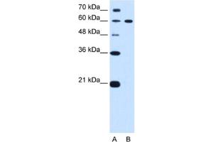 Western Blotting (WB) image for anti-Deltex Homolog 2 (DTX2) antibody (ABIN2462679) (DTX2 anticorps)